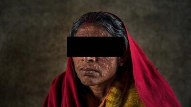 مرض الكلازار